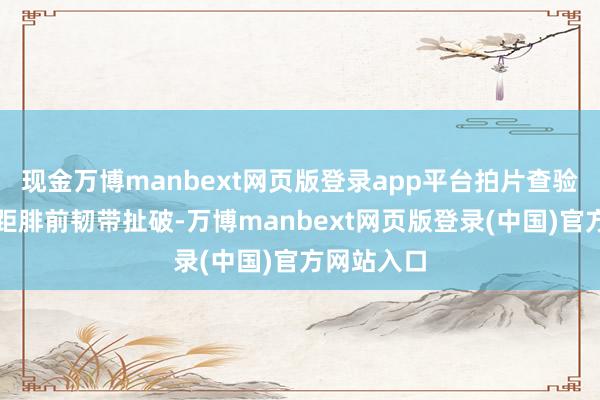 现金万博manbext网页版登录app平台拍片查验效果露馅距腓前韧带扯破-万博manbext网页版登录(中国)官方网站入口